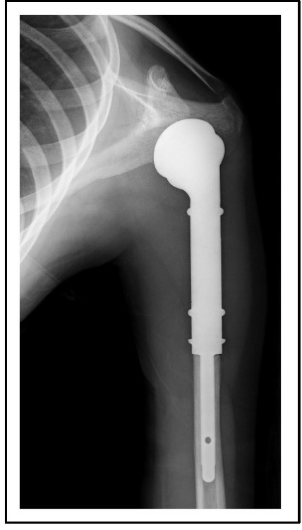 Gelenkrekonstruktion