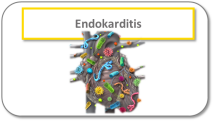 Endokarditis